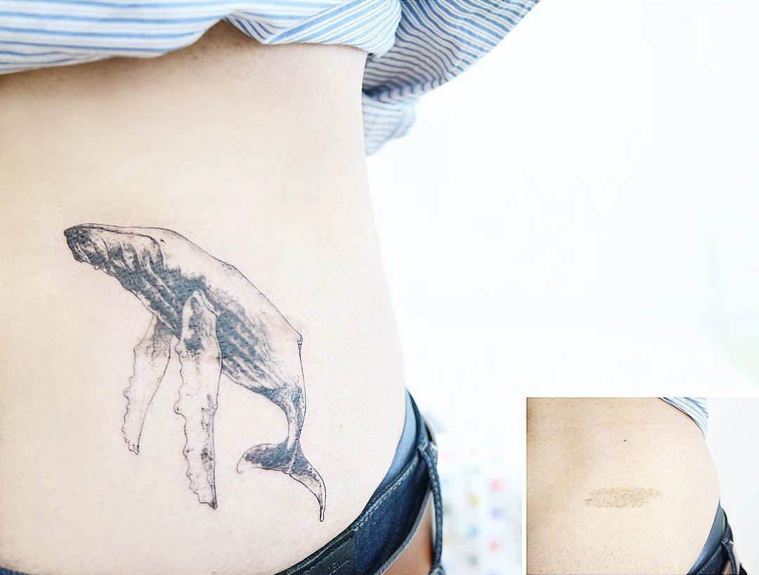 scar cover up whale tattoo